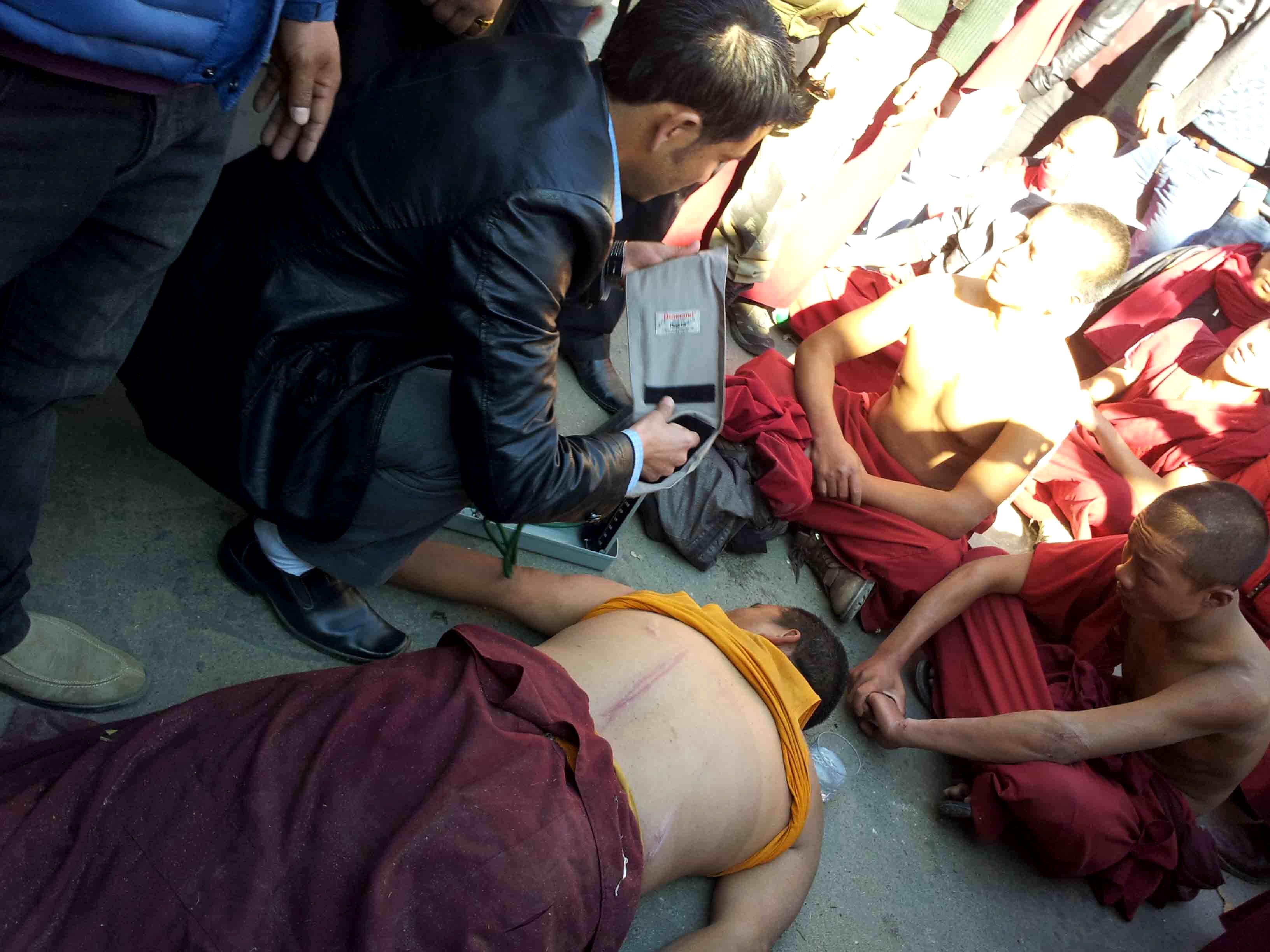 A monk beaten up by police during protests being attended by a medical officer on the Tawang streets while protesting against dams
